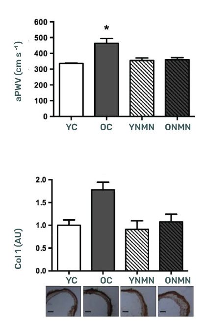 NMN supplmentation significantly improved arterial health on mice