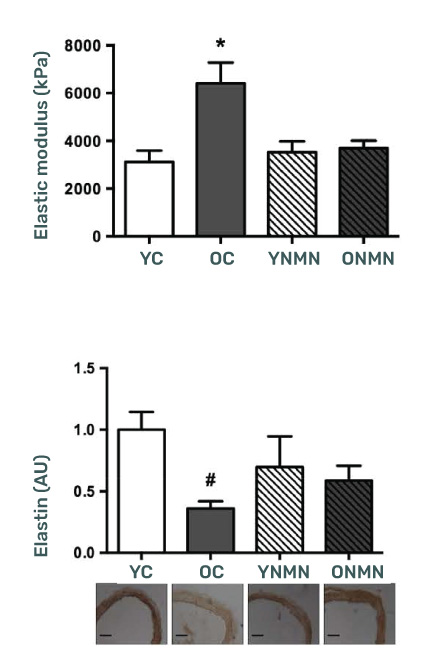 NMN Supplementation reduced arterial stiffness compared to untreated old mice